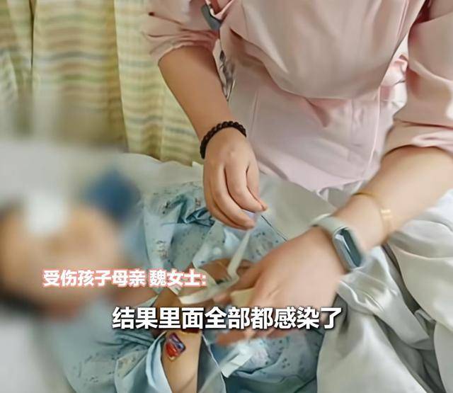 江西一5岁男孩在幼儿园被戳伤致左眼失明<strong></p>
<p>广联达股票</strong>，家长称老师用猪油涂抹试图消肿
