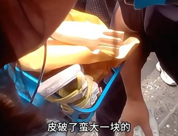 看着都疼<strong></p>
<p>步步高股票</strong>！上海街头一男子突然求助：10岁女儿被死死卡住！这个行为太危险→